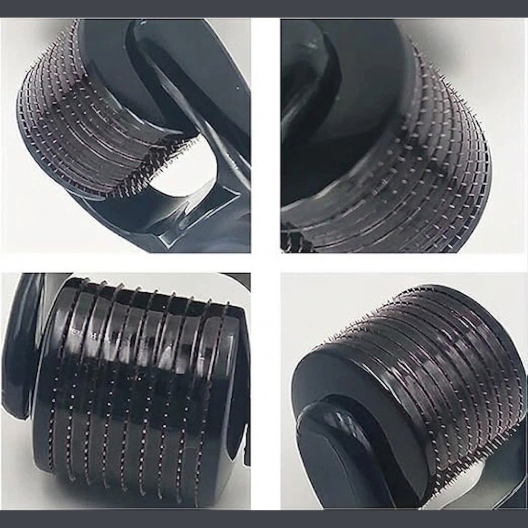 Black Derma Skin Roller – Best Selling in UK - Image 3