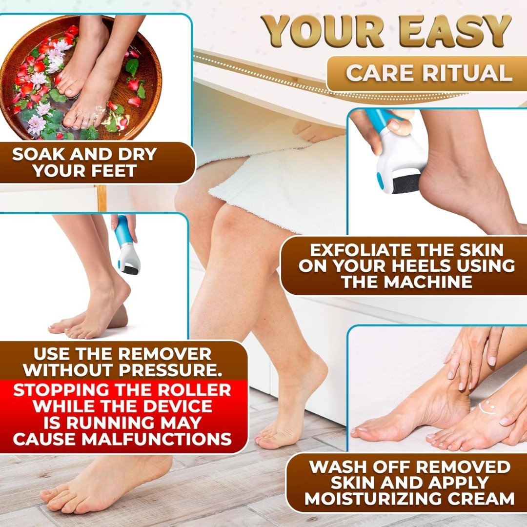 Electric Foot Grinder – Best Selling in UK - Image 5
