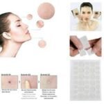 Hydrocolloid Acne Patches – Best Selling Product in UK