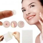Hydrocolloid Acne Patches – Best Selling Product in UK - Image 2