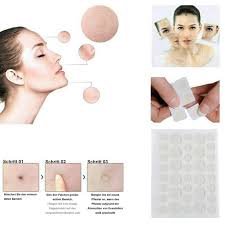 Hydrocolloid Acne Patches – Best Selling Product in UK