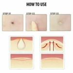 48PCS Skin Tag & Acne Patch – hydrocolloid acne patches UK for Acne, Pimples & Scar Healing - Image 4