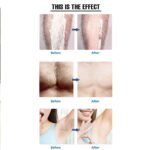 Crystal Hair Removal Device – Best Selling in UK - Image 5