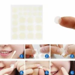 48PCS Skin Tag & Acne Patch – hydrocolloid acne patches UK for Acne, Pimples & Scar Healing - Image 2