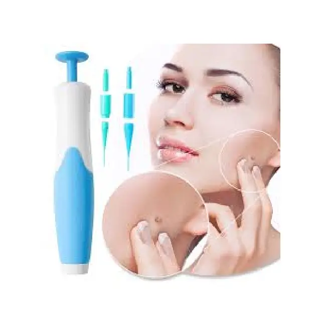 Skin Tag Removal Tool with Box – Painless Skin Tag Removal Kit – Best Selling Product in UK